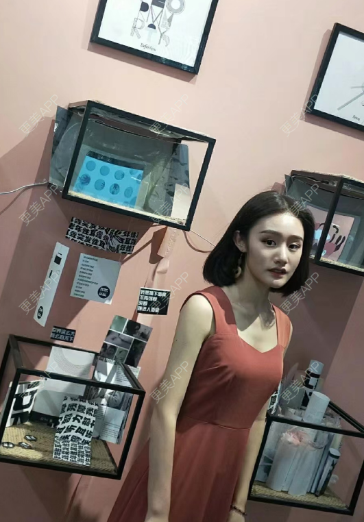 更美 - 更美用户vYv9CoVcFL的超声溶脂瘦大腿经验 | 超声溶脂 | 超声溶脂瘦大腿