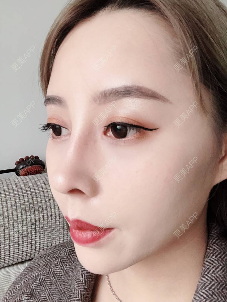 歪头怪脑的鼻综合日记