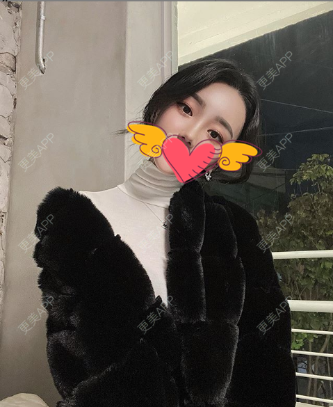 更美 - 曲漾啥的硅胶垫眉弓经验 | 北京 | 硅胶垫眉弓