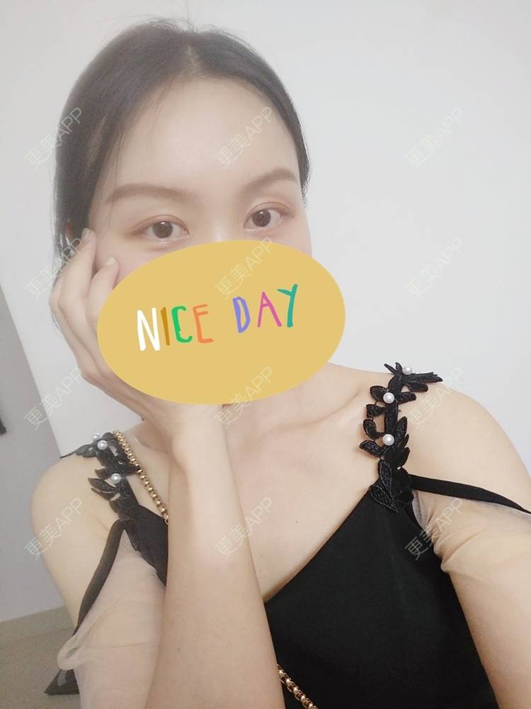 更美 - 更美用户1fHxMDJVIE的眼部多项经验 | 眼部多项 | 广州