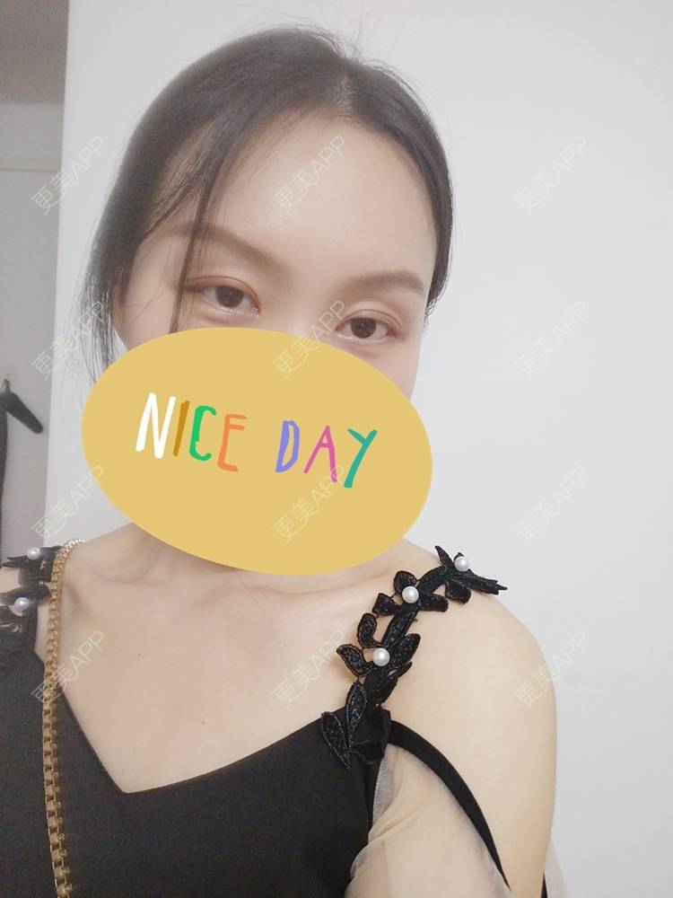 更美 - 更美用户1fHxMDJVIE的眼部多项经验 | 眼部多项 | 广州