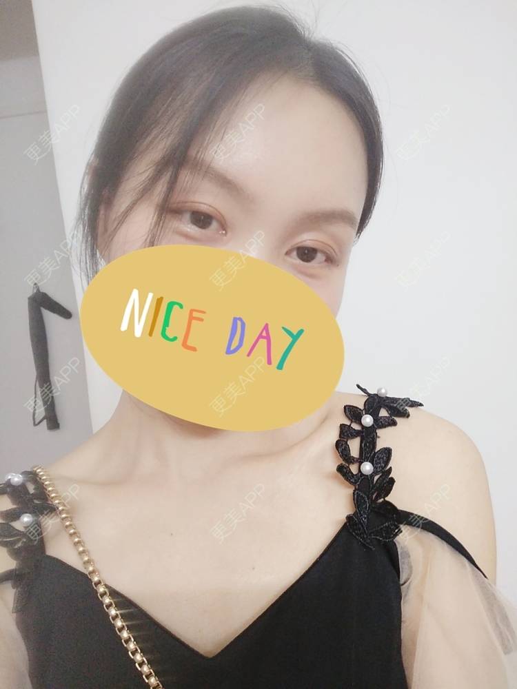 更美 - 更美用户1fHxMDJVIE的眼部多项经验 | 眼部多项 | 广州