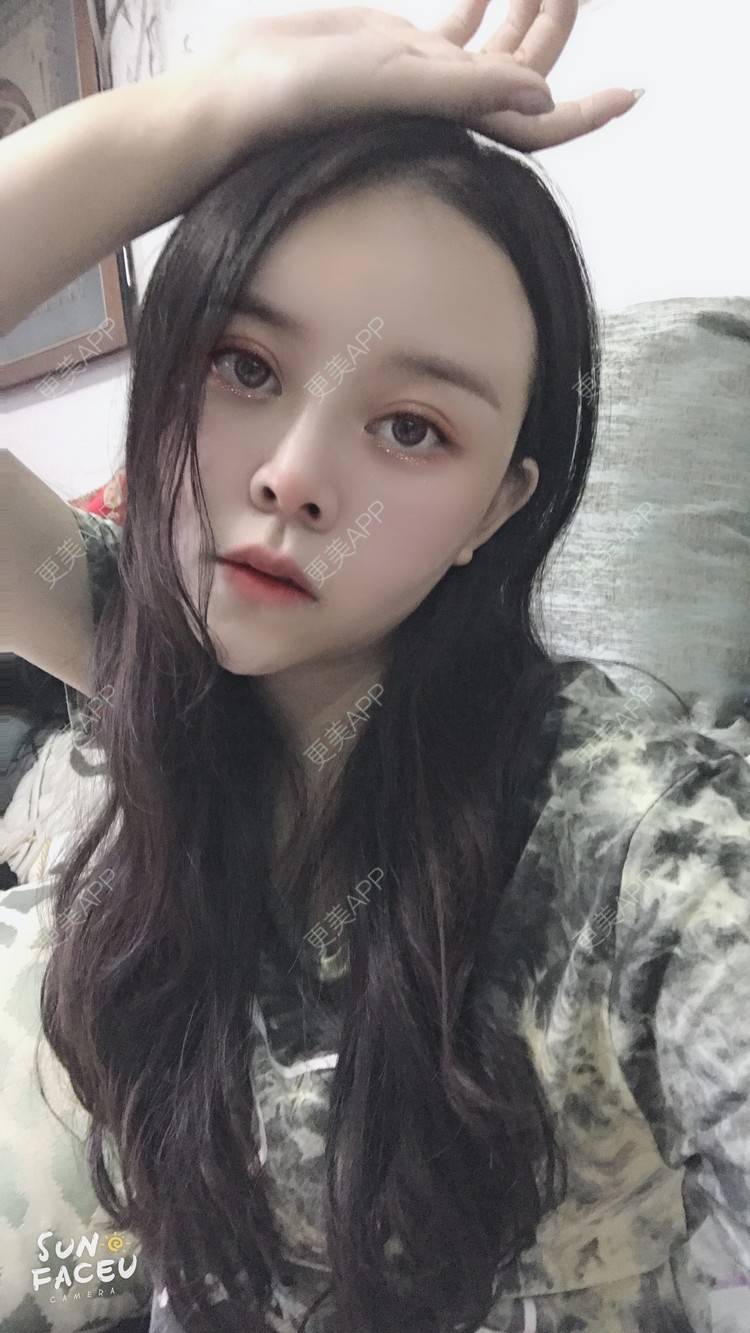 更美 - 更美用户iuB00h31N3的鼻部多项经验 | 鼻部多项 | 肋软骨隆鼻 | 广州