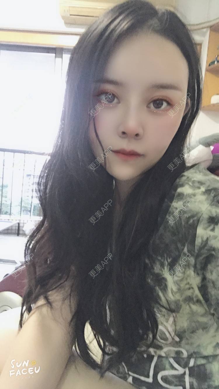 更美 - 更美用户iuB00h31N3的鼻部多项经验 | 鼻部多项 | 肋软骨隆鼻 | 广州