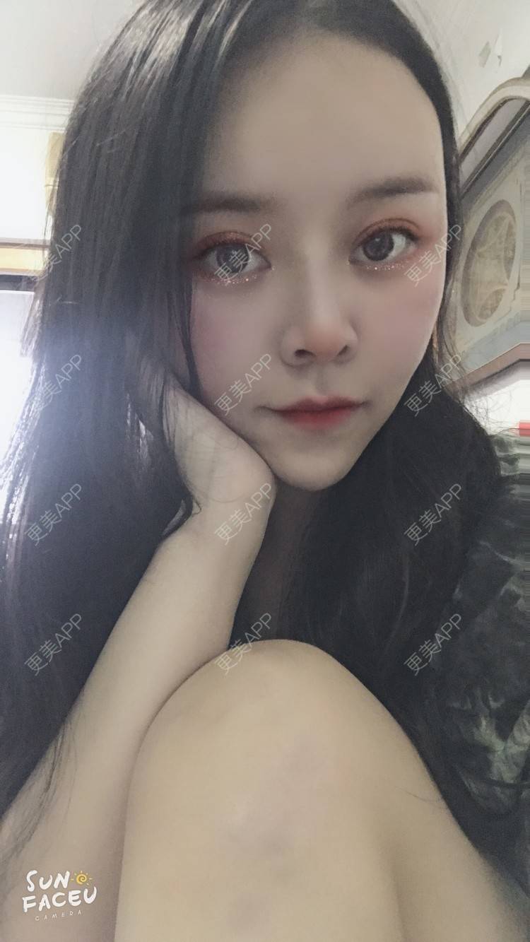 更美 - 更美用户iuB00h31N3的鼻部多项经验 | 鼻部多项 | 肋软骨隆鼻 | 广州