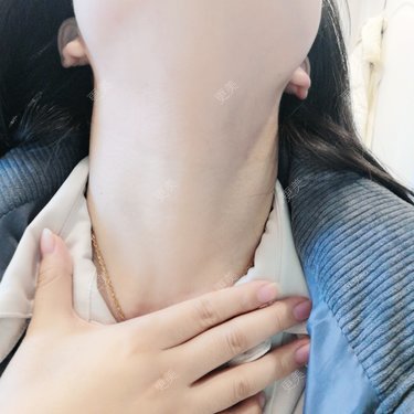 c年糕