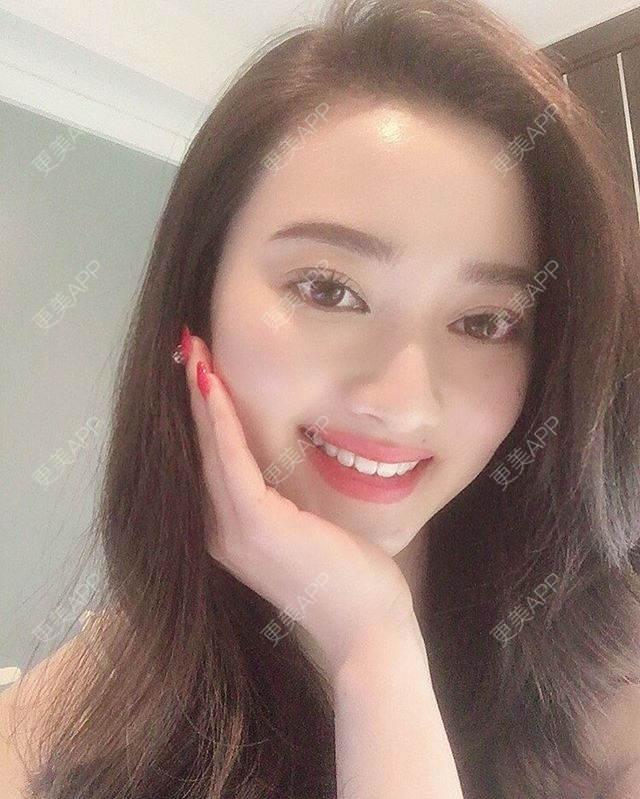 更美 - 更美用户FG1TRthJhI的全瓷牙经验 | 全瓷牙
