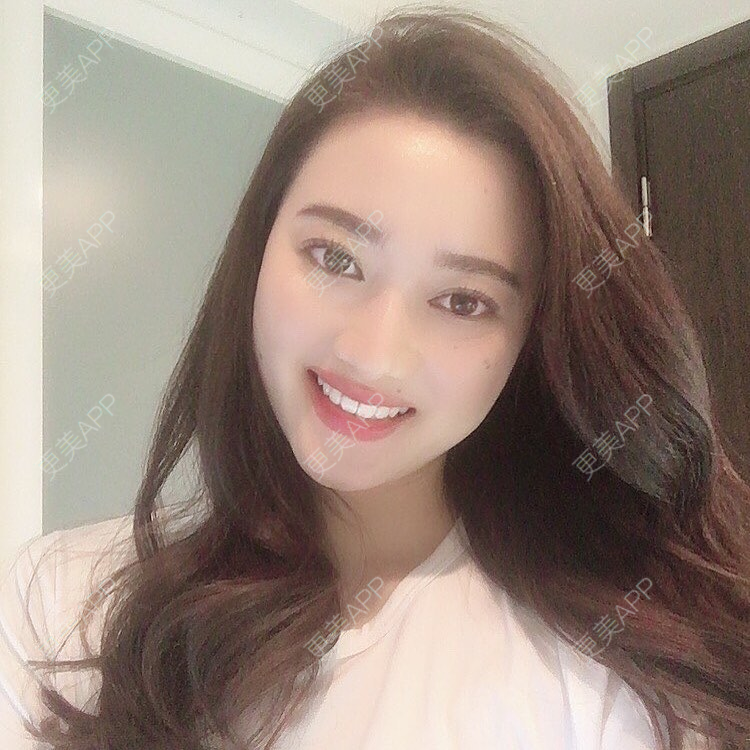 更美 - 更美用户FG1TRthJhI的全瓷牙经验 | 全瓷牙