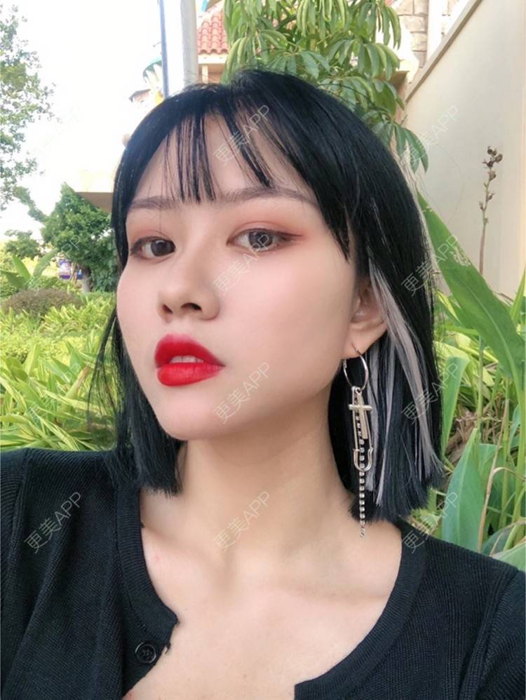 更美 - 玉子燒、的激光脱发际线经验 | 广州 | 大腿脱毛