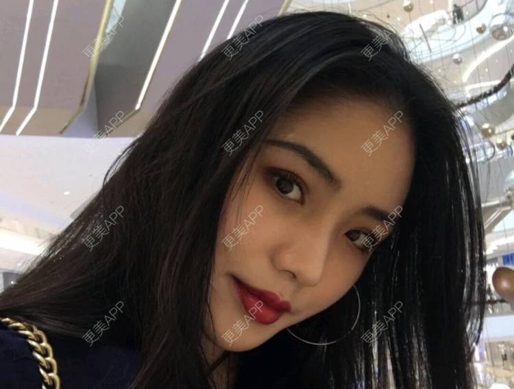 更美 - 名字随便取的鼻部综合经验 | 鼻部综合 | 南昌