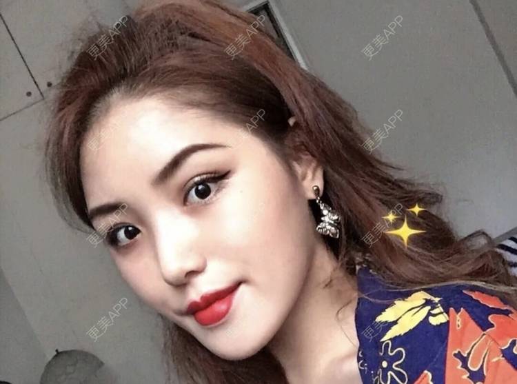 更美 - 名字随便取的鼻部综合经验 | 鼻部综合 | 南昌