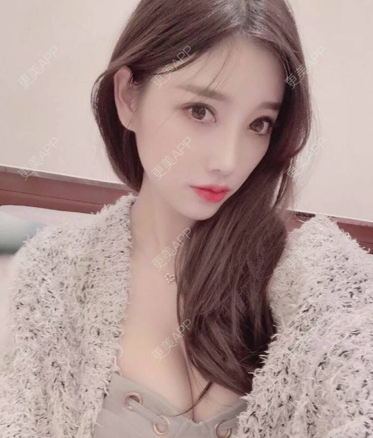 更美 - 更美用户AraIUakfMw的自体脂肪丰臀经验 | 自体脂肪丰臀 | 广州