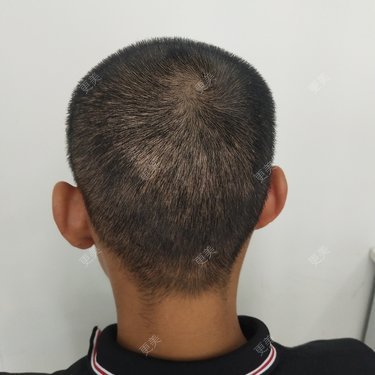 更美用户3uyrzcH0tC