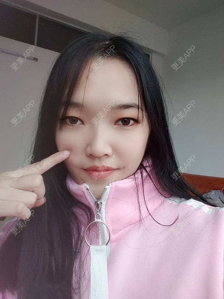 更美 - 更美用户d3VL5UQGsk的热拉提经验 | 上海 | 热拉提