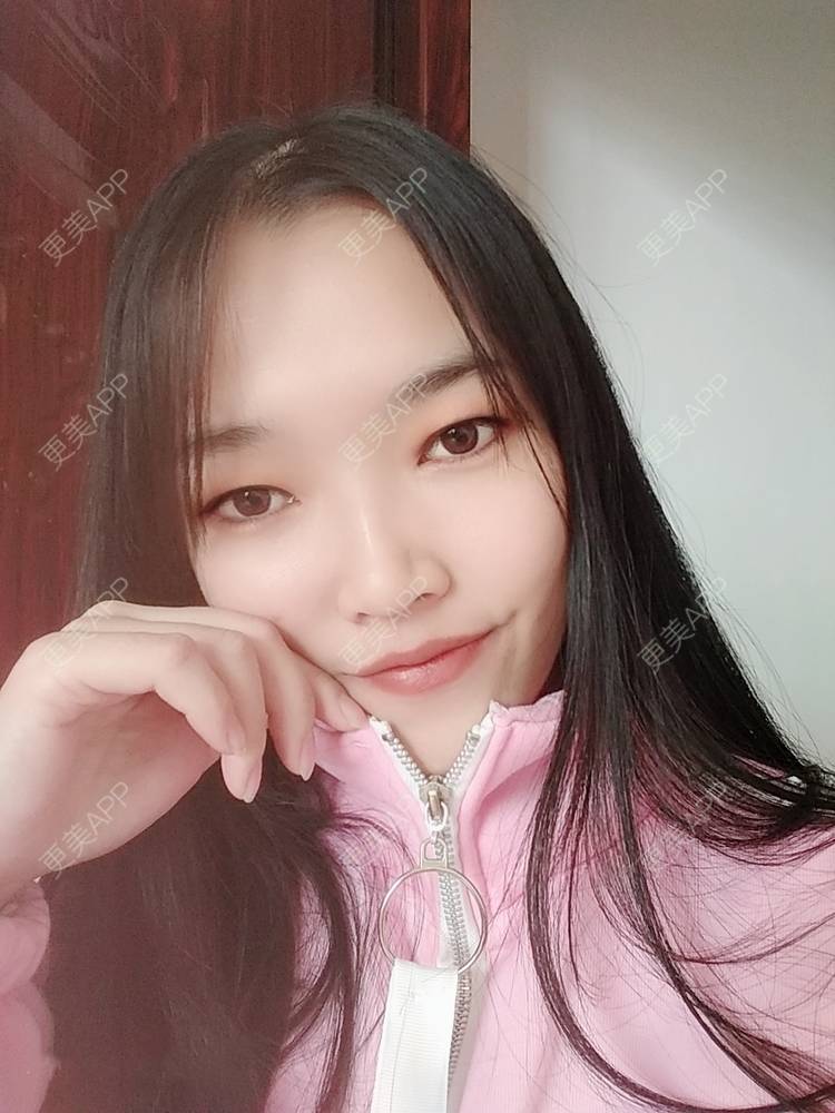 更美 - 更美用户d3VL5UQGsk的热拉提经验 | 上海 | 热拉提