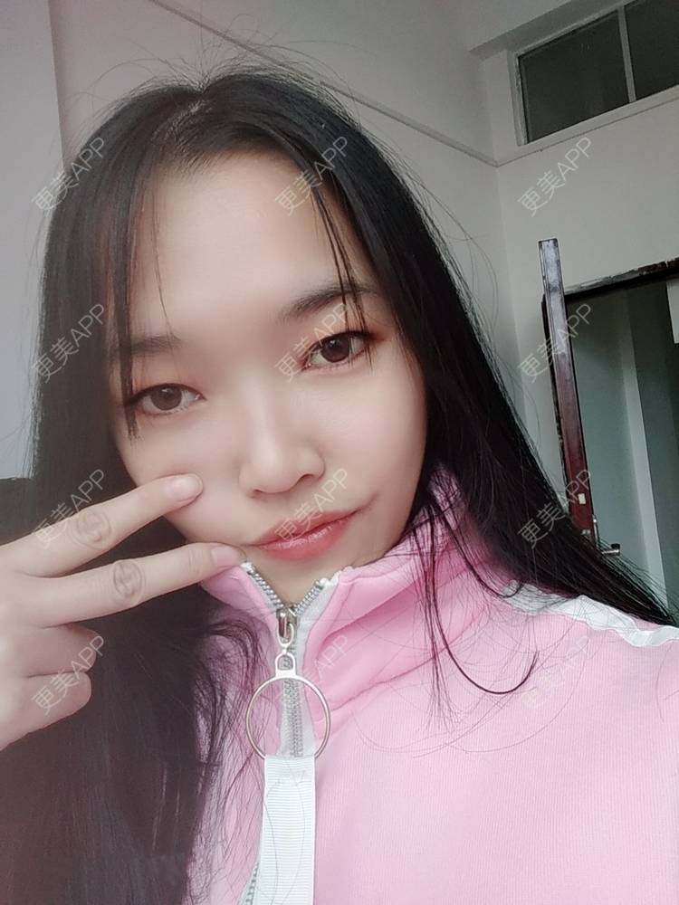 更美 - 更美用户d3VL5UQGsk的热拉提经验 | 上海 | 热拉提