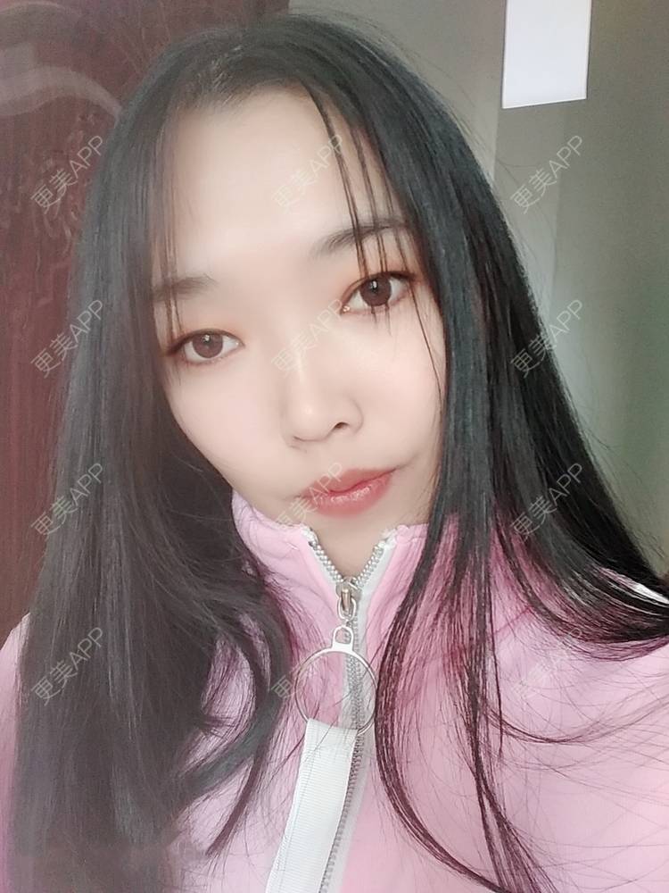 更美 - 更美用户d3VL5UQGsk的热拉提经验 | 上海 | 热拉提