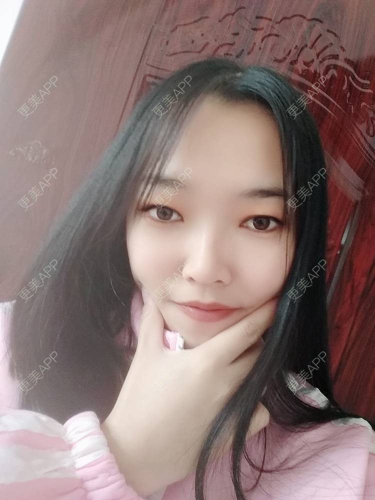 更美 - 更美用户d3VL5UQGsk的热拉提经验 | 上海 | 热拉提