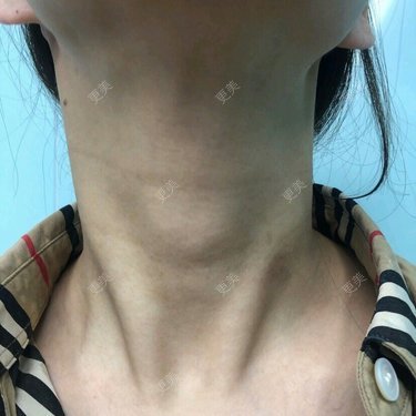 更美用户H8z9RMv1GZ