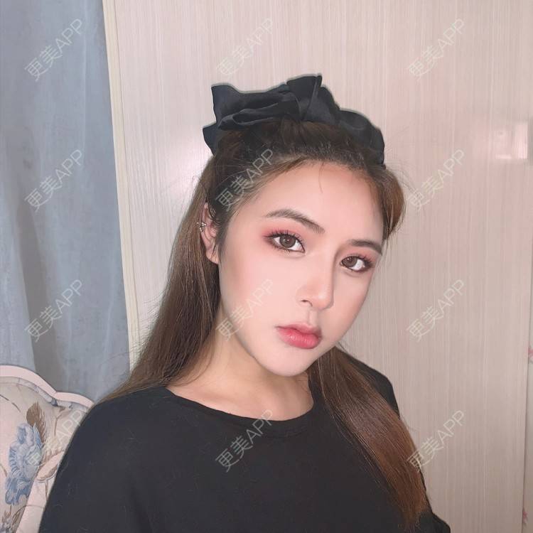 更美 - 思涵baby的鼻部多项经验 | 深圳 | 鼻部多项