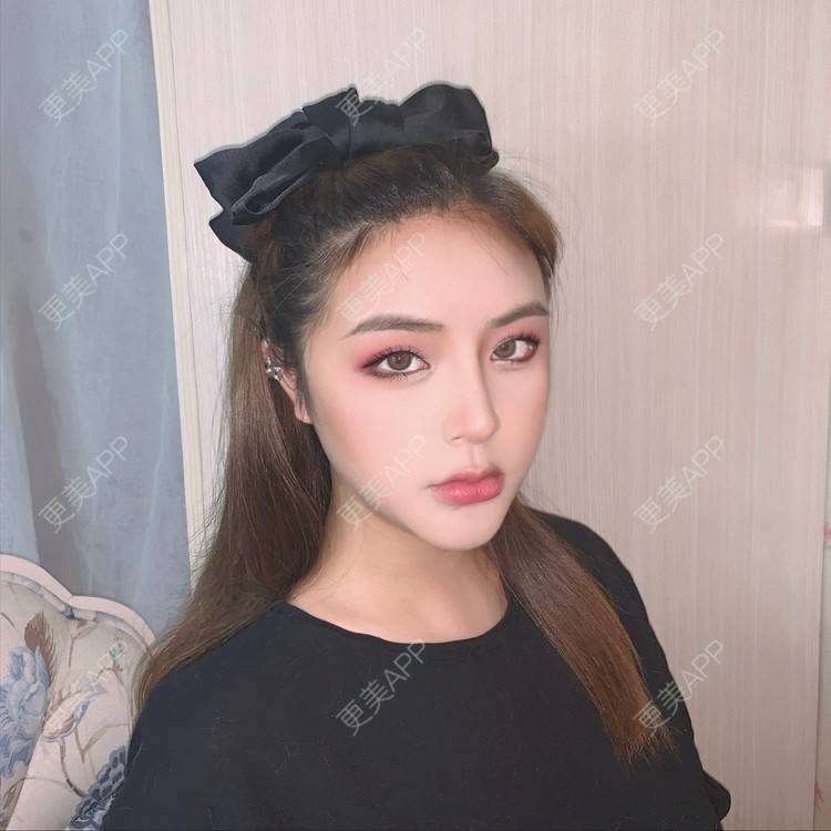 更美 - 思涵baby的鼻部多项经验 | 深圳 | 鼻部多项