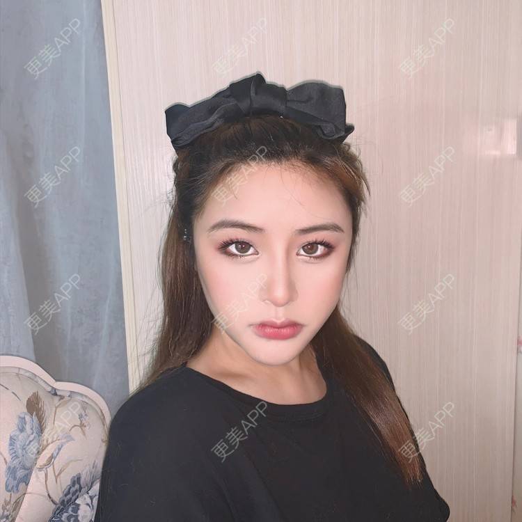 更美 - 思涵baby的鼻部多项经验 | 深圳 | 鼻部多项