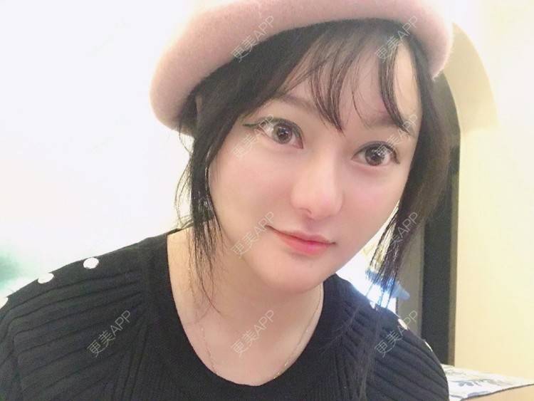 更美 - 三生有幸呀的硅胶垫下巴经验 | 硅胶垫下巴 | 膨体垫下巴 | 宽下巴矫正 | 下巴硅胶假体取出 | 下巴膨体假体取出