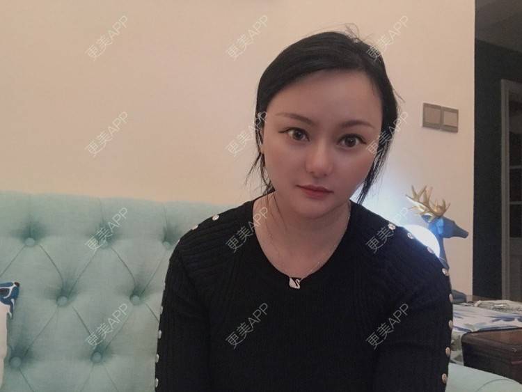 更美 - 三生有幸呀的硅胶垫下巴经验 | 硅胶垫下巴 | 膨体垫下巴 | 宽下巴矫正 | 下巴硅胶假体取出 | 下巴膨体假体取出