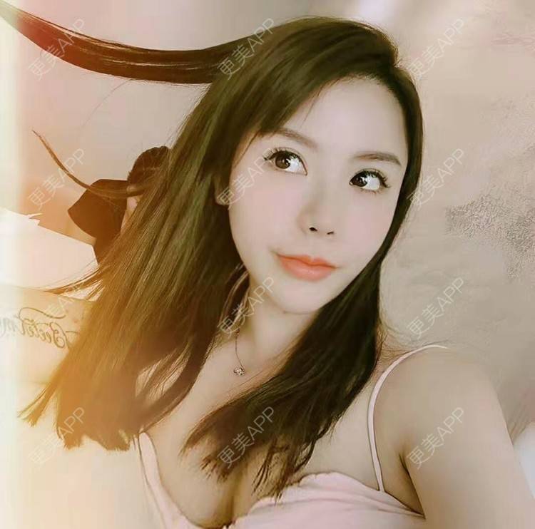更美 - 猫耳朵的生活的自体脂肪填充法令纹经验 | 自体脂肪填充法令纹 | 自体脂肪隆胸 | 深圳 | 超声溶脂瘦手臂 | 超声溶脂瘦腹部 | 超声溶脂瘦背部