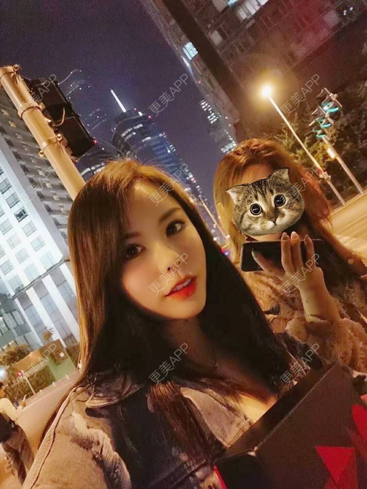 更美 - 猫耳朵的生活的自体脂肪填充法令纹经验 | 自体脂肪填充法令纹 | 自体脂肪隆胸 | 深圳 | 超声溶脂瘦手臂 | 超声溶脂瘦腹部 | 超声溶脂瘦背部