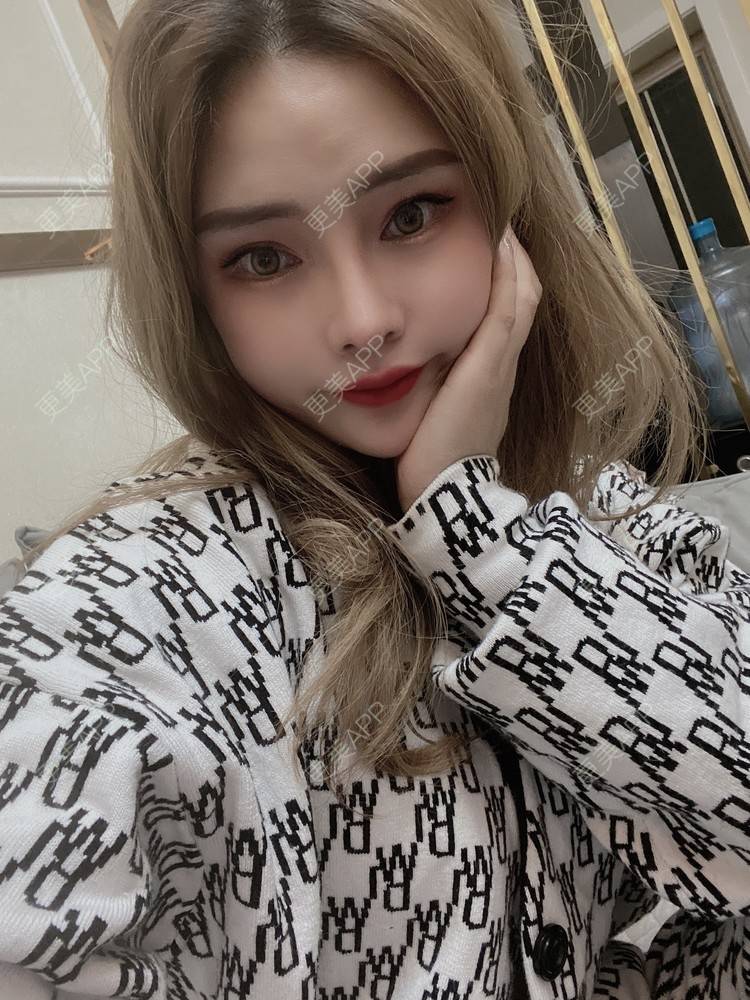 更美 - 大CC阿姨的肋软骨隆鼻经验 | 成都 | 肋软骨隆鼻 | 视频日记