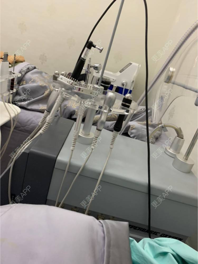 更美 - 温桐的玻尿酸下巴经验 | 玻尿酸下巴 | 杭州