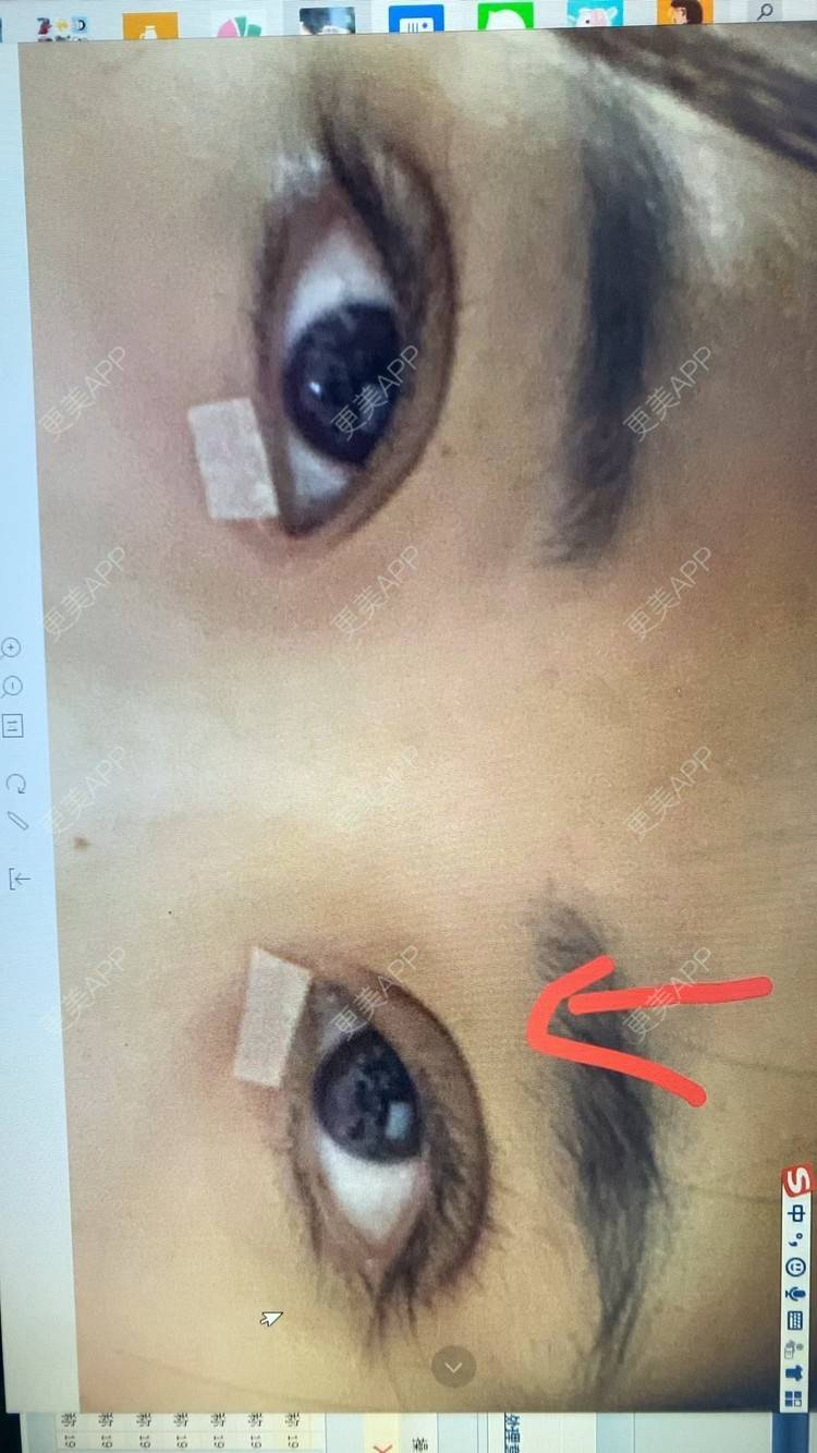 更美 - if you if的开内眼角经验 | 上海 | 眼部多项