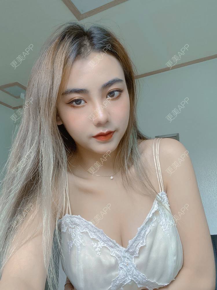 更美 - 更美用户IyTX4zwALn的隆胸手术修复经验 | 假体隆胸 | 隆胸手术修复 | 美胸套餐 | 手术去副乳 | 乳头内陷矫正 | 苏州