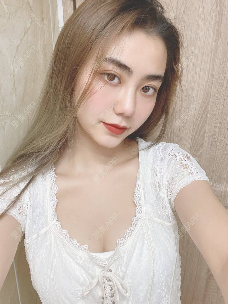 更美 - 更美用户IyTX4zwALn的隆胸手术修复经验 | 假体隆胸 | 隆胸手术修复 | 美胸套餐 | 手术去副乳 | 乳头内陷矫正 | 苏州