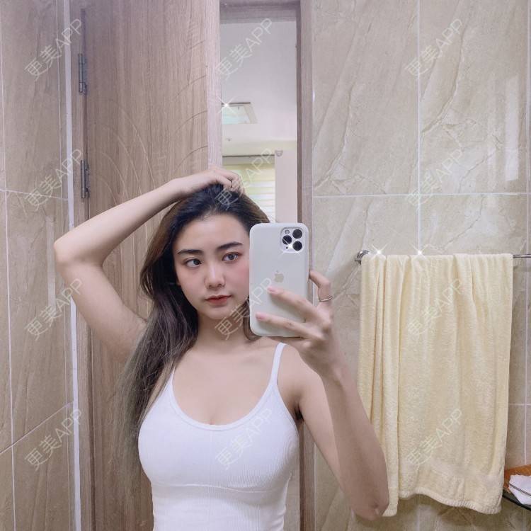 更美 - 更美用户IyTX4zwALn的隆胸手术修复经验 | 假体隆胸 | 隆胸手术修复 | 美胸套餐 | 手术去副乳 | 乳头内陷矫正 | 苏州