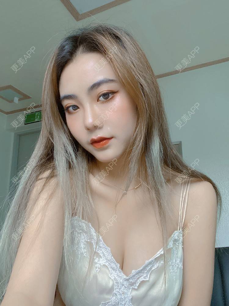 更美 - 更美用户IyTX4zwALn的隆胸手术修复经验 | 假体隆胸 | 隆胸手术修复 | 美胸套餐 | 手术去副乳 | 乳头内陷矫正 | 苏州