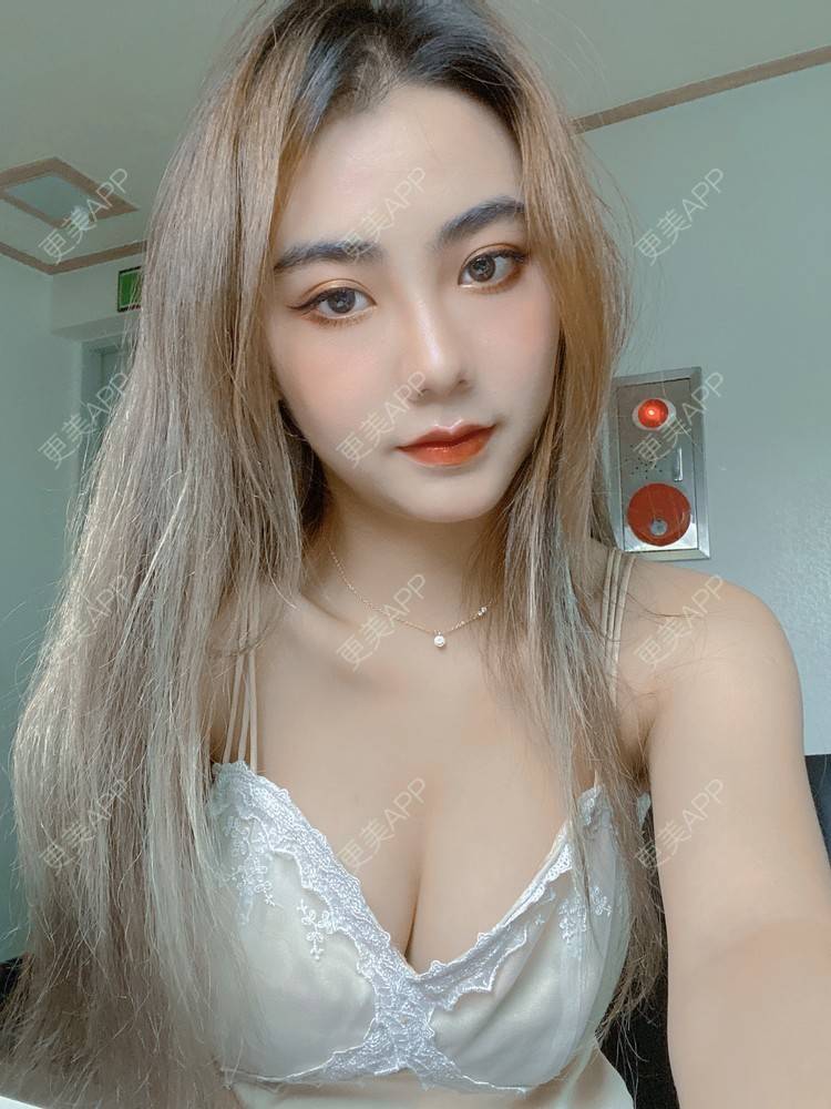 更美 - 更美用户IyTX4zwALn的隆胸手术修复经验 | 假体隆胸 | 隆胸手术修复 | 美胸套餐 | 手术去副乳 | 乳头内陷矫正 | 苏州