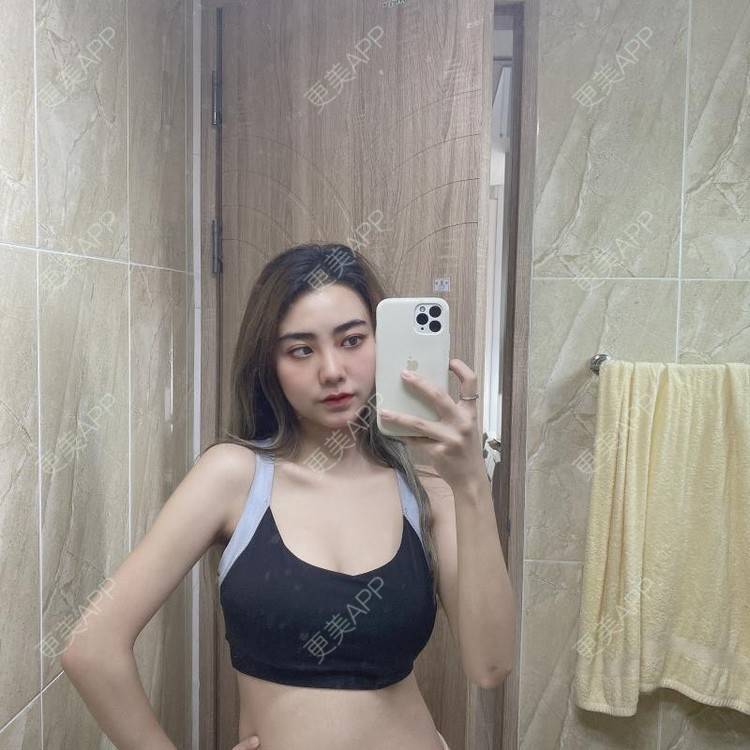 更美 - 更美用户IyTX4zwALn的隆胸手术修复经验 | 假体隆胸 | 隆胸手术修复 | 美胸套餐 | 手术去副乳 | 乳头内陷矫正 | 苏州