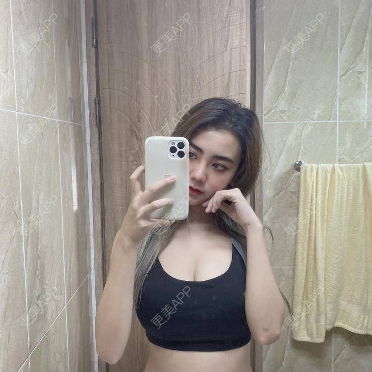更美 - 更美用户IyTX4zwALn的隆胸手术修复经验 | 假体隆胸 | 隆胸手术修复 | 美胸套餐 | 手术去副乳 | 乳头内陷矫正 | 苏州