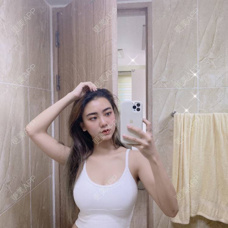 更美 - 更美用户IyTX4zwALn的隆胸手术修复经验 | 假体隆胸 | 隆胸手术修复 | 美胸套餐 | 手术去副乳 | 乳头内陷矫正 | 苏州