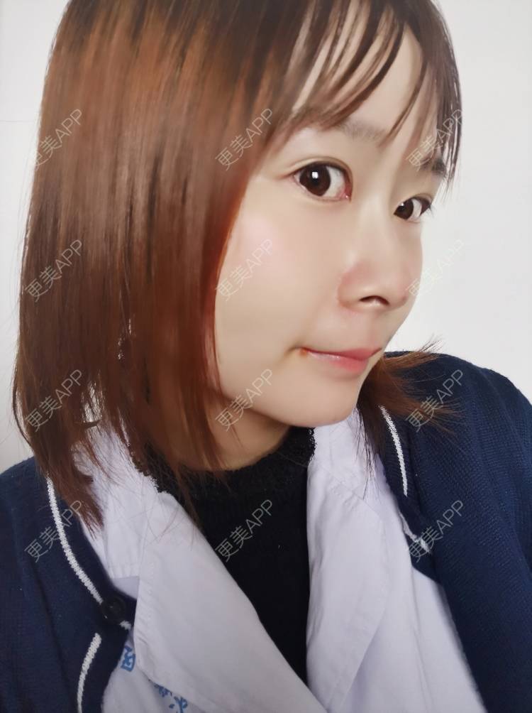 更美 - 更美用户srpv6JiXYY的玻尿酸苹果肌经验 | 玻尿酸苹果肌 | 上海