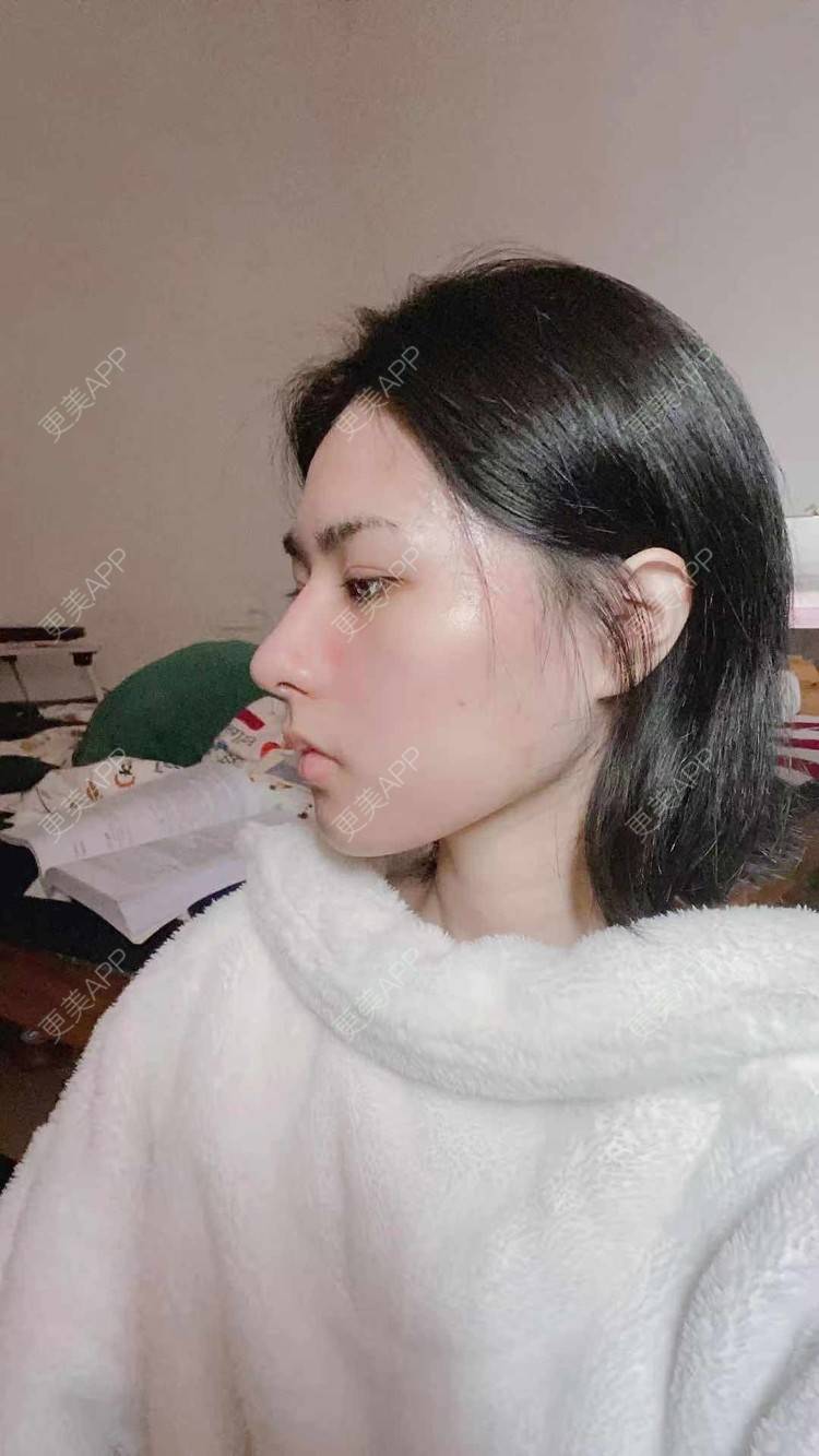 更美 - ヌ酷还可爱ˇ男的鼻部多项经验 | 鼻部多项 | 重庆