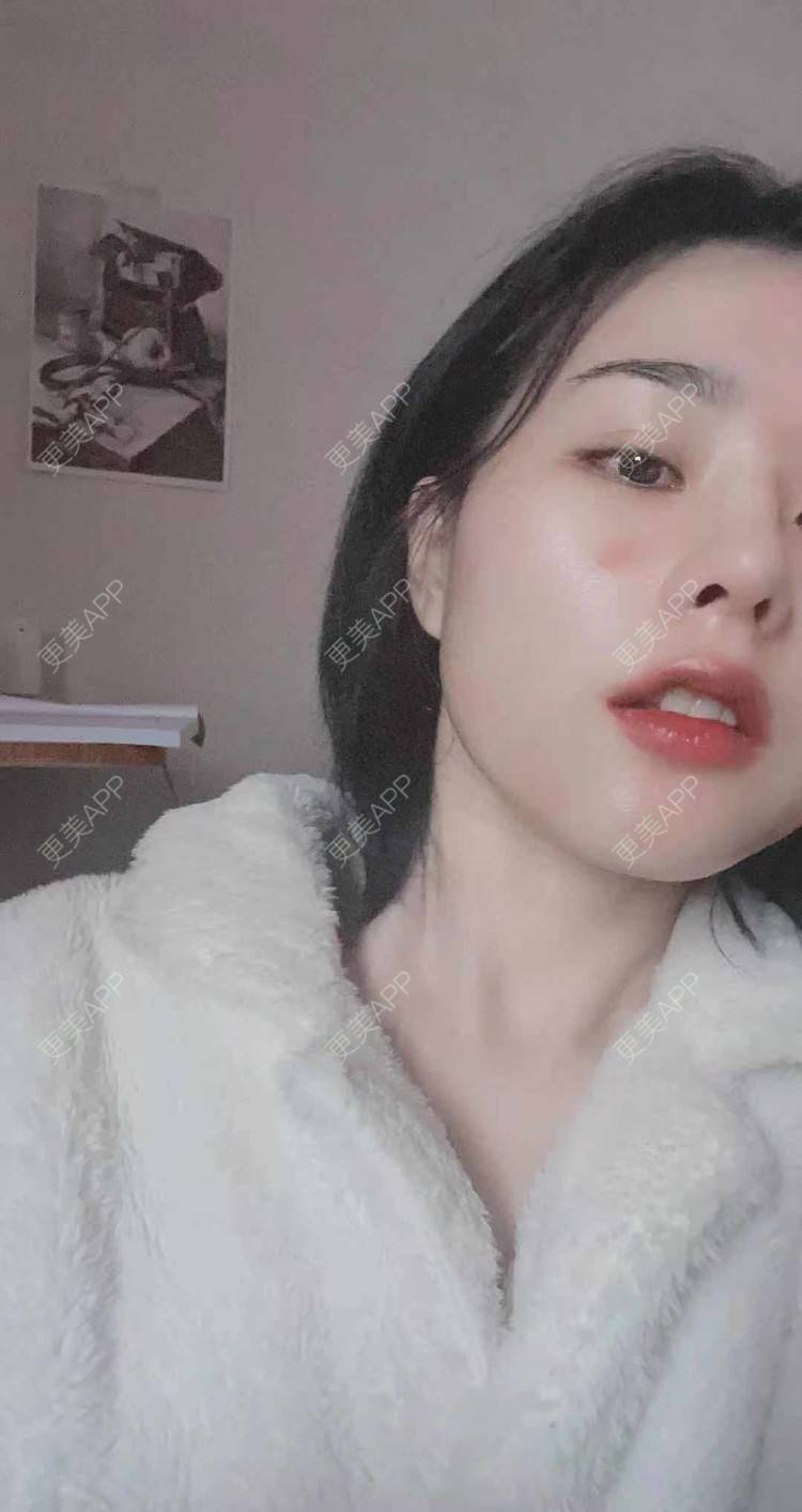 更美 - ヌ酷还可爱ˇ男的鼻部多项经验 | 鼻部多项 | 重庆