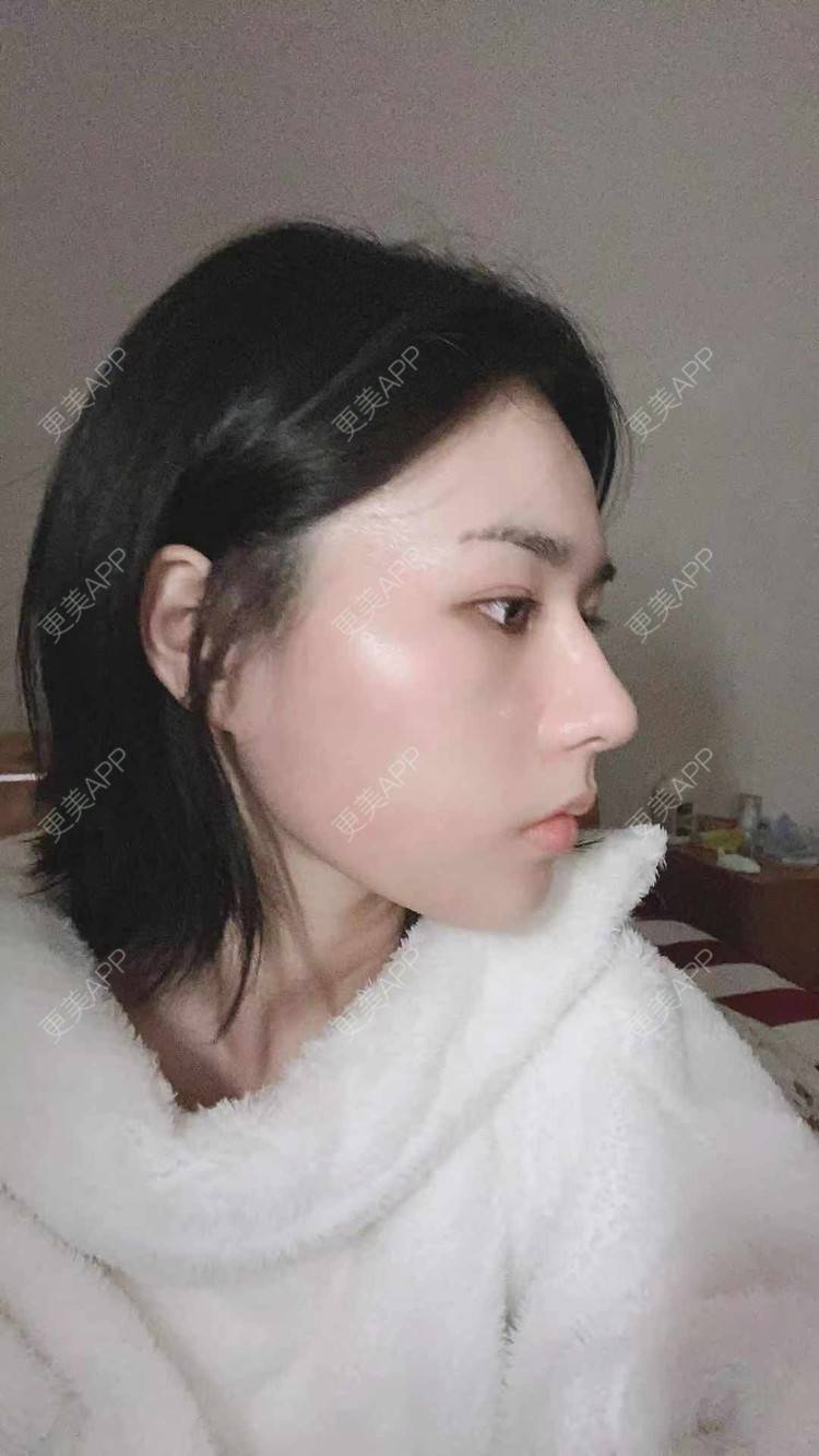 更美 - ヌ酷还可爱ˇ男的鼻部多项经验 | 鼻部多项 | 重庆