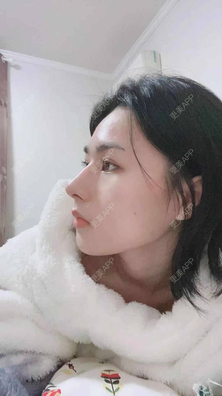 更美 - ヌ酷还可爱ˇ男的鼻部多项经验 | 鼻部多项 | 重庆