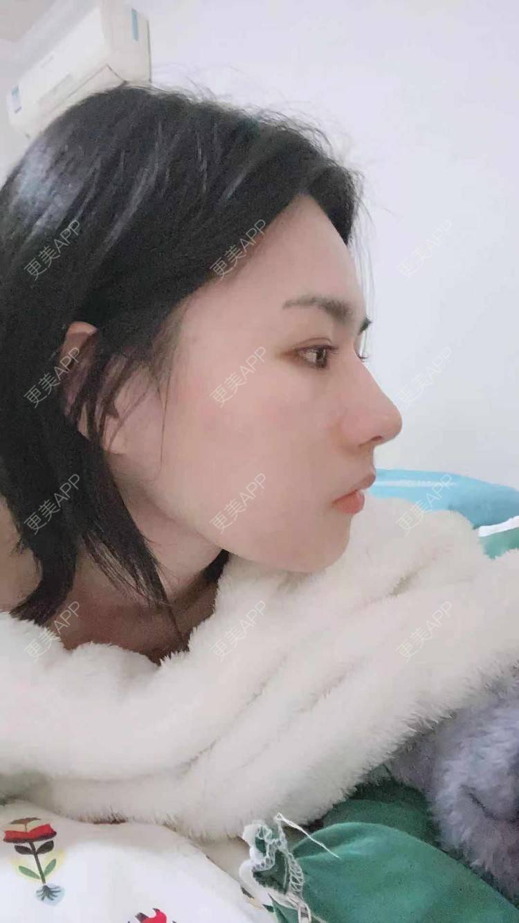 更美 - ヌ酷还可爱ˇ男的鼻部多项经验 | 鼻部多项 | 重庆