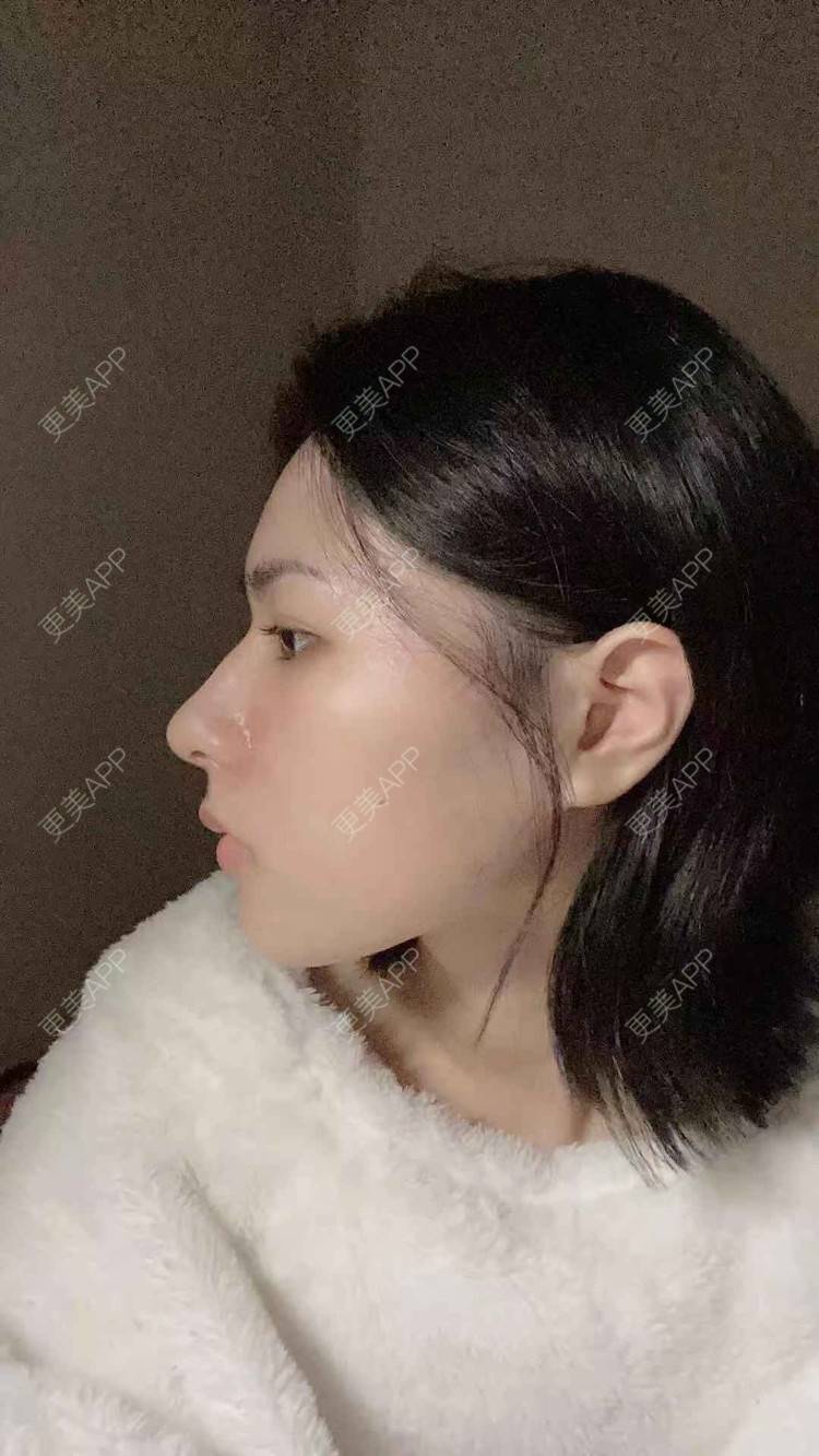 更美 - ヌ酷还可爱ˇ男的鼻部多项经验 | 鼻部多项 | 重庆