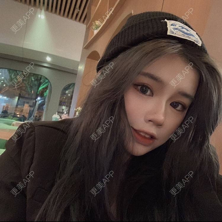 更美 - 更美用户DWKIxrCW9n的玻尿酸鼻部经验 | 玻尿酸鼻部 | 玻尿酸下巴 | 广州