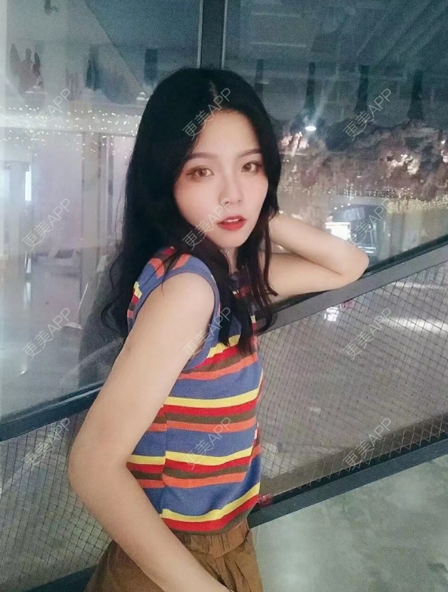 更美 - 更美用户8cGlQgtMJv的超声溶脂瘦腹部经验 | 超声溶脂瘦腹部 | 超声溶脂